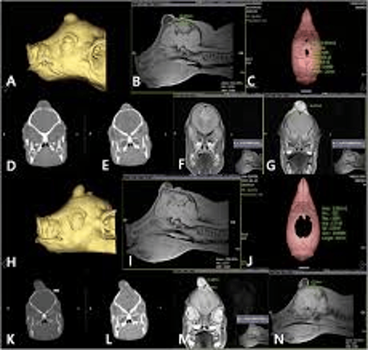 <p>Breed affected: All pigs</p><p>Appearance: large hernia in the skull</p><p>-lethal recessive (some have lived for studies)</p><p>Test: N/A</p>