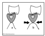 <p>conical</p>