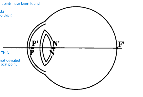 <p>where would we stick a thin lens in gullstrands exact eye model </p>