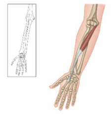 <p>What is the origin for the flexor carpi radialis?</p>