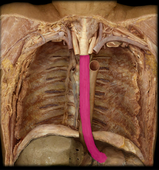 <p>What organ is this?</p>