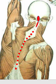 <p>What is red-lighted, is it an origin/insertion, and for what muscle?</p>