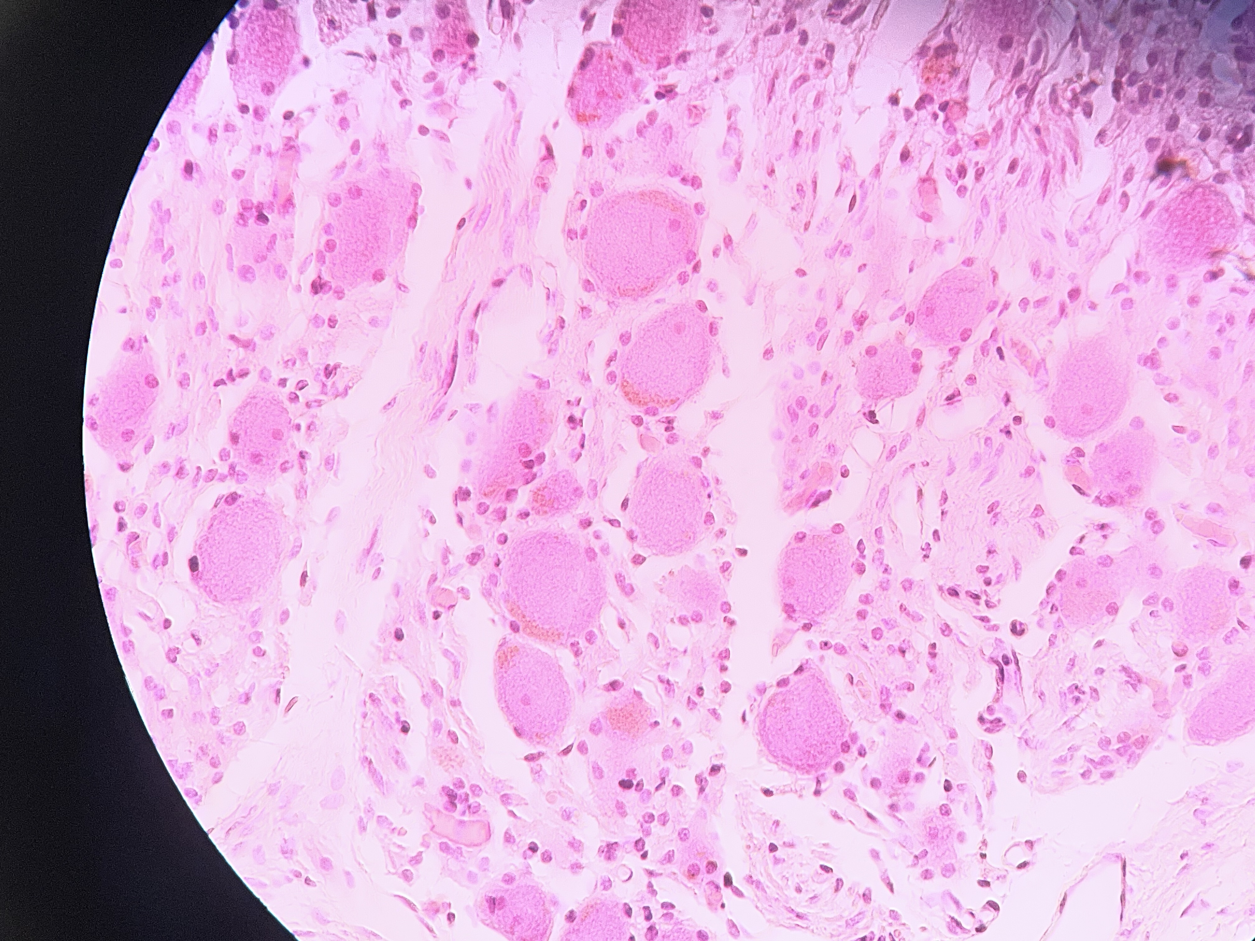 <p>This sample shows evidence of what cell inclusion that is indicative of old age and or large stressors within the animals life?</p>