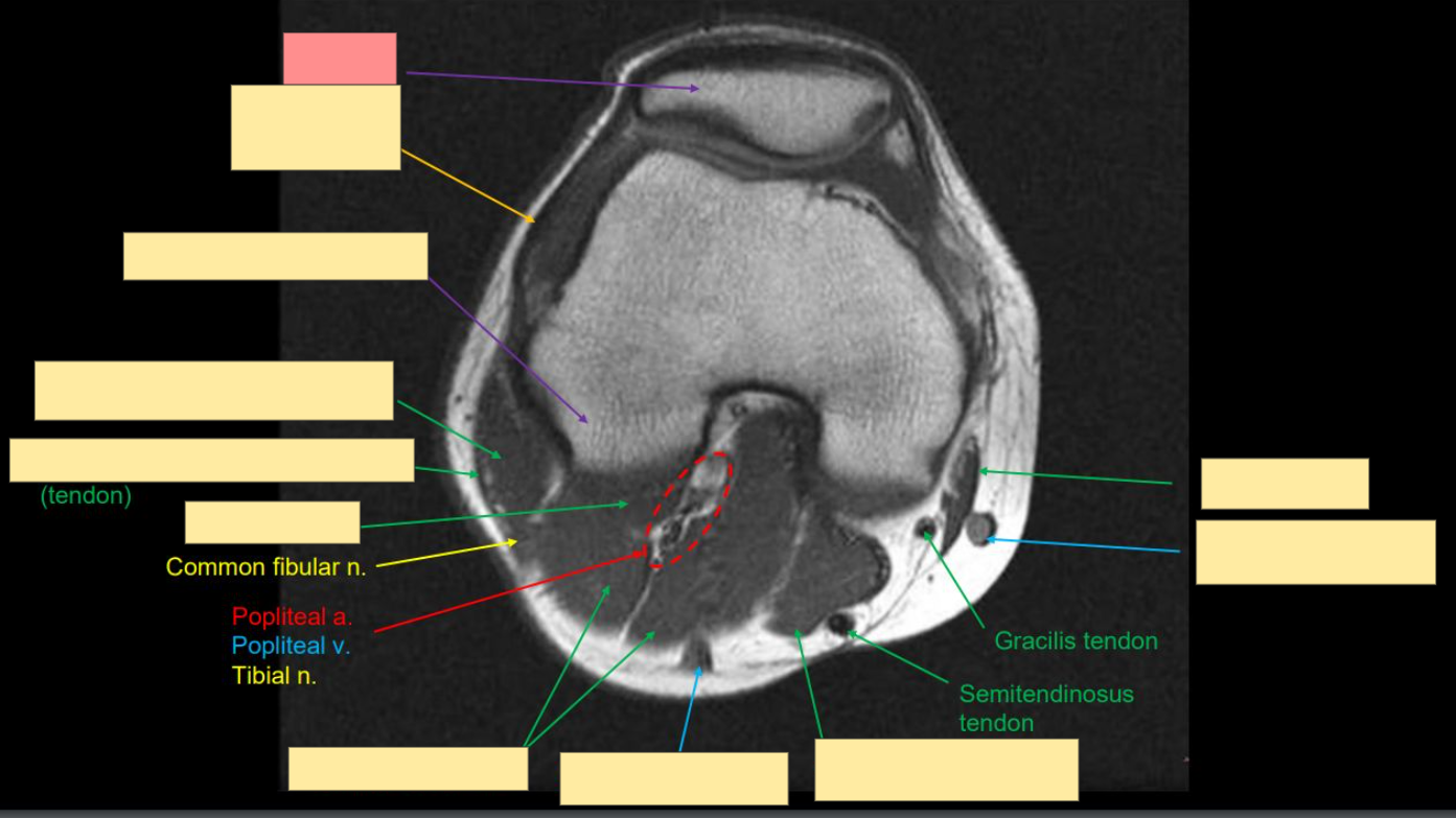 <p>Identify the structure</p>