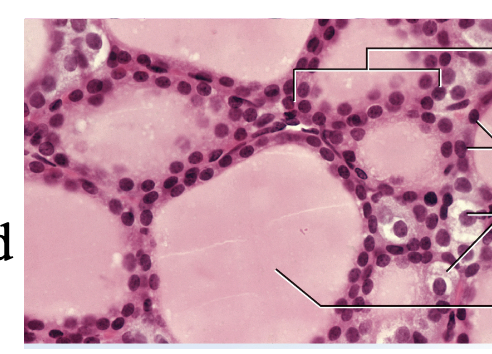<p>what do the throid follicles contian and what are they surrounded by</p>