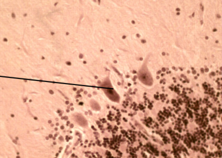 <p>common in cerebellum</p>