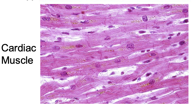 <ul><li><p><strong>Striated</strong>, but <strong>branches</strong></p></li><li><p>Can be multi-nucleated, sometimes binucleate nucleated, but <strong>usually mono-nucleated</strong></p></li><li><p>Dark lines - Z</p></li><li><p>Light lines - M</p></li></ul><p></p>