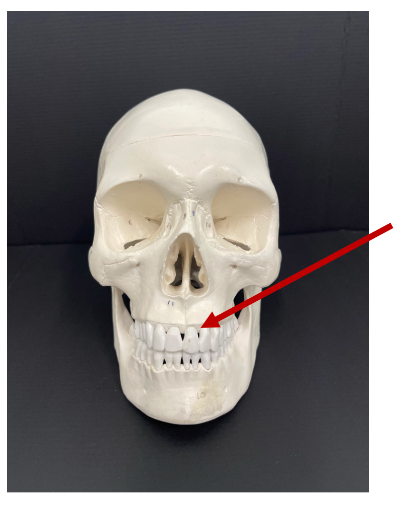 <p>Identify the bony landmark of the maxilla that the red arrow is pointing to.</p>