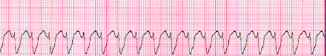<p>what waveform is this</p>