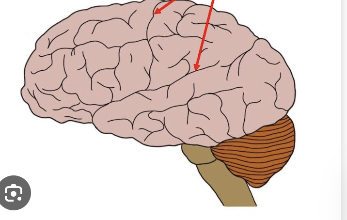 <p>What brain part is this?</p>