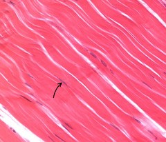 <p>What cell is indicated by the area in this connective tissue?</p>