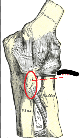 <p>What bone landmark is this within the <strong>Ulna</strong></p><ul><li><p>Medial Forarm Bone; Antebrachial, Ulnar Region)</p></li></ul><p></p>