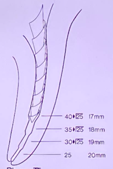 <p><span>ideally its just <strong>3 files bigger</strong>: 30 35, 40, 45</span></p><p>its objective is to create a tapering conical shape</p><p>stepping back procedure in 1mm increments<strong> </strong>(go 1 mm short - standard)</p><p>r<span><strong>ecapitulation with no. 25 file </strong>till full working length → as you go shorter, you have to increase the diameter of the canal</span></p><p>Now <strong>apical area is prepared </strong>and steps are produced</p><ul><li><p><span>master apical file (MAF)</span></p></li><li><p><span><strong>initial apical file (IAF) </strong>→ first file being introduced in the canal (apically) aside from patency files depending on the size of the canal</span></p></li><li><p><span><em>(6, 8, 10 files cannot be your IAF since they are only used to check if the canal is present)</em></span></p></li></ul><p></p>
