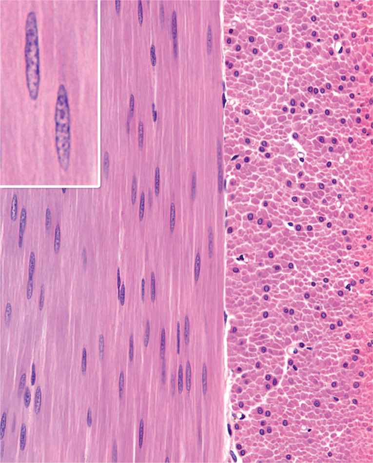 <p>Patterned collagen fibers, tendons and ligaments</p>