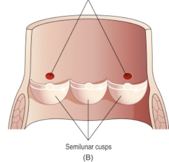 <p>dots inside pulmonary trunk…</p>