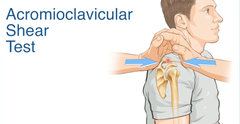 <p>Squeeze heels of hands together over clavicle and scapula spine; identifies AC dysfunction.</p>