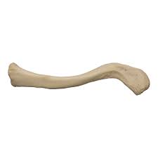 <p>What detached bone is this?</p>