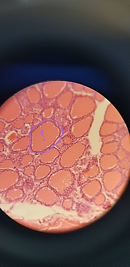 <p>what is outlined?</p>