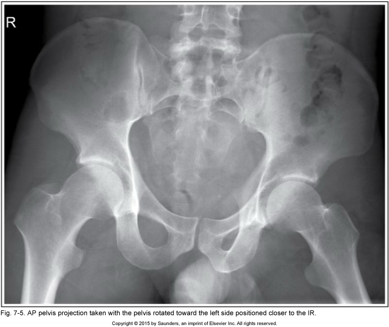 <p>AP pelvis</p>