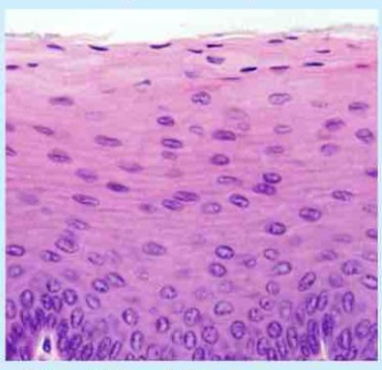 <p>Protection, lining of the esophagus, skin epidermis, all body openings such as mouth, ear, urethra, anus and vagina</p>
