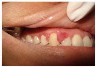 <p>CHẨN ĐOÁN?</p>