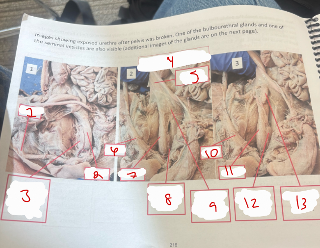 <p>Male Urogenital System 6</p>