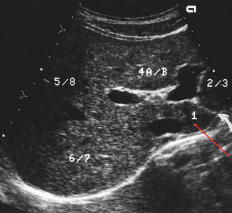 <p>what’s the arrow pointing at </p>