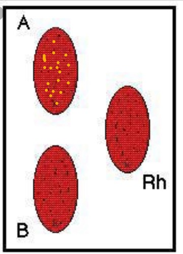 <p>What is the blood type indicated by the results in the right tray?</p>