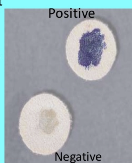 <p><strong>Located</strong>: Normal skin flora</p><p><strong>Appearance</strong>: Yellow pigment on BA</p><p><strong>Associated with</strong>: abscesses, septic arthritis, endocarditis, pneumonia & meningitis</p><p><strong>Other tests</strong>: Microdase (modified oxidase) it detects cytochrome enzyme</p><p>Micrococcus is <span style="color: blue;">blue</span> (+) Staphylococcus has <span style="color: rgb(110, 110, 97);">no color</span><span style="color: rgb(219, 221, 160);"> </span>(-)</p>