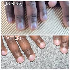 <p>Blue/gray/slate/dark purple discoloration of skin or mucus mems</p><p>Caused by deoxygenated/reduced hemoglobin in the blood</p><p>May occur w/ decreased Cardiac Output</p>