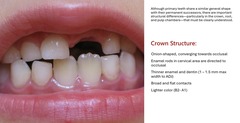 <p>-onionshaped, converging towards occlusal</p><p>-enamel rods in cervical areas directed toward the occlusal</p><p>-thinner enamel and dentin </p><p>-broad and flat contacts</p><p>-lighter (B2-A1)</p>