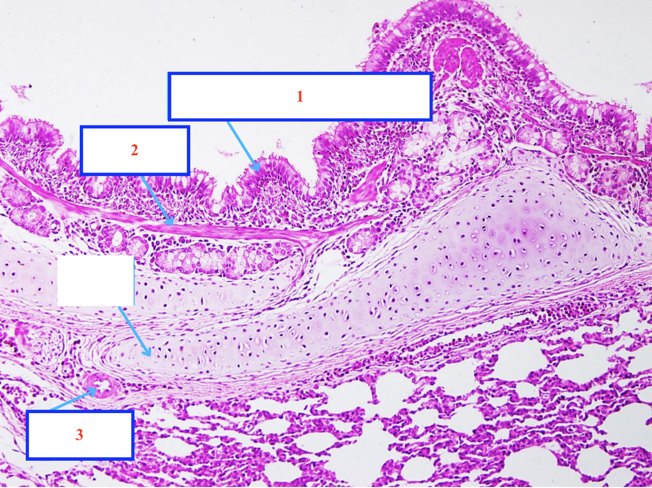 <ol><li><p>Biểu mô gì ?</p></li><li><p>Cấu trúc gì ?</p></li><li><p>Cấu trúc gì ?</p></li></ol><p></p>