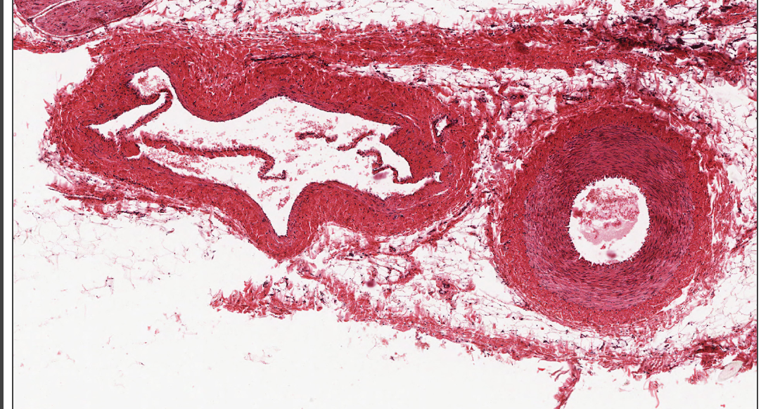 <p>Which is an artery and which is a vein?</p>