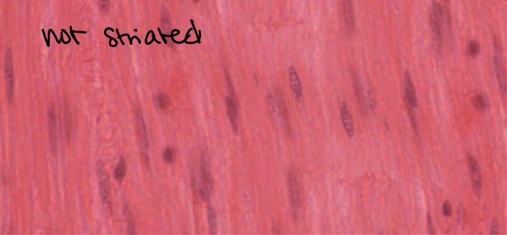 <p>Smooth muscle. Muscle that lines hollow internal organs. Controlled involuntarily by the brain and endocrine system. Not striated.</p>