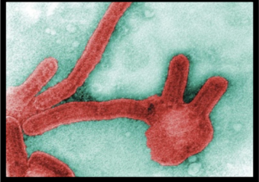 <p><span style="background-color: transparent;"><strong>How dangerous is the Marburg virus?&nbsp;&nbsp;</strong></span></p>