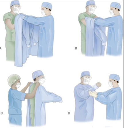 <ol><li><p>sterile person picks up the gown by the neckband, holds it at arm’s length, and allows it to unfold</p></li><li><p>gown is held by the shoulder seams with the outside facing the sterile person</p></li><li><p>sterile gloves are protected by placing both hands under the back panel of the gown’s shoulder</p></li><li><p>arms are slipped into the sleeves in a downward motion, sliding the gown up to the mid-upper arms</p></li><li><p>nonsterile circulator pulls the gown up and fastens the back and waistband of the gown</p></li><li><p>gently pull the cuff back over the person’s hands, being careful that your gloved hands do not touch the bare hands </p></li></ol><p></p>