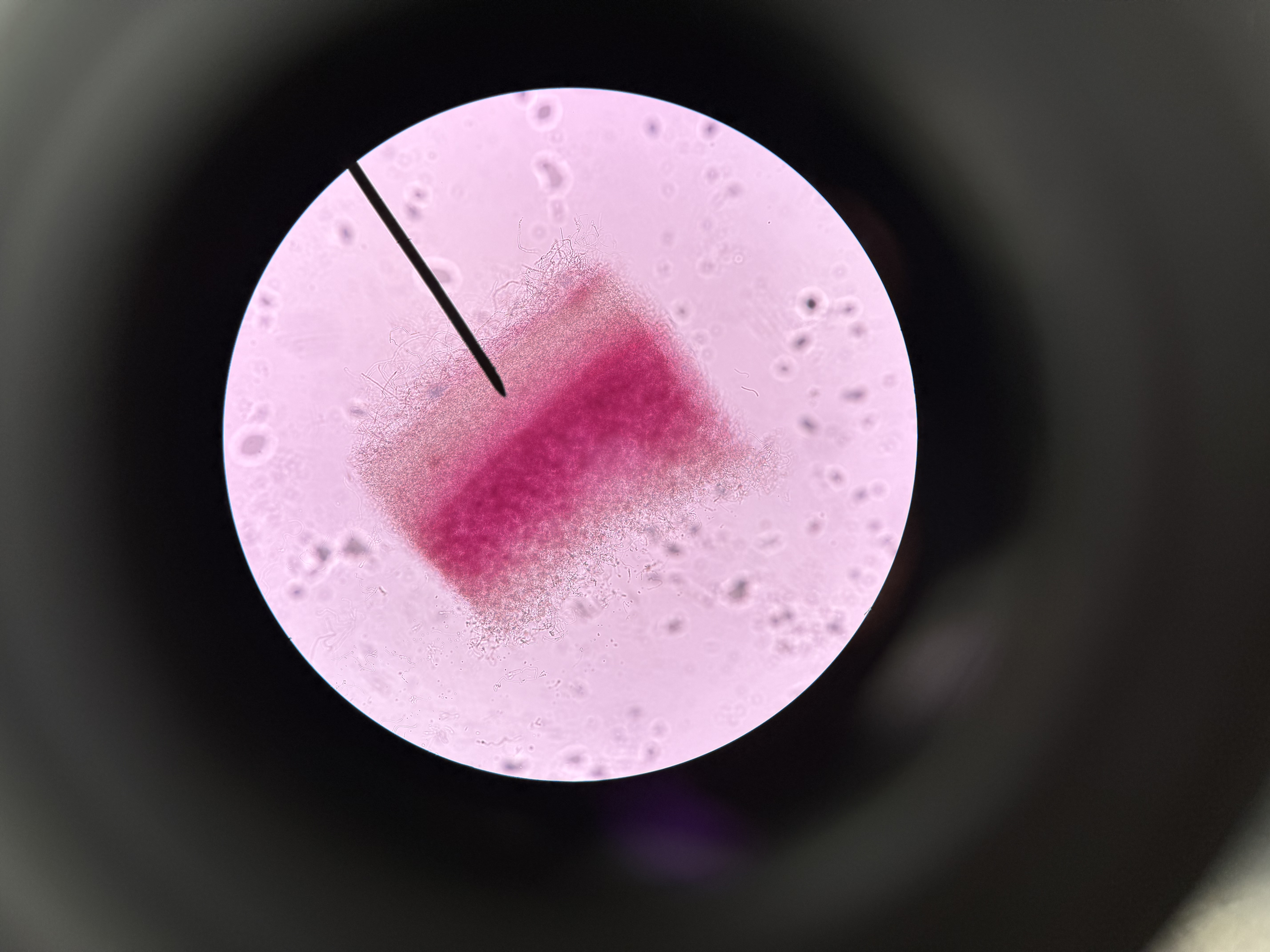 <ol><li><p>What is this?</p></li><li><p>What phylum?</p></li><li><p>Spore location?</p></li><li><p>What type of fungi?</p></li><li><p>What is the hyphae?</p></li><li><p>What is the conidiophores</p></li><li><p>What is the conidia?</p></li></ol><p></p>