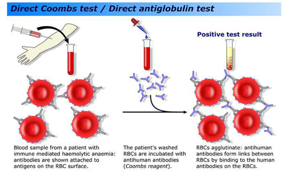 <p>- test for antibodies coating red blood cells</p>
