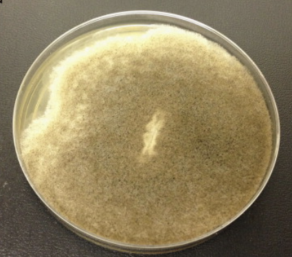 <p>occasionally agent of zygomycosis. seen in leukemia patients.</p><p>rapid growth (can grow at high temps, 54C), wooly, olive-gray to pale brown surface, white reverse.</p>