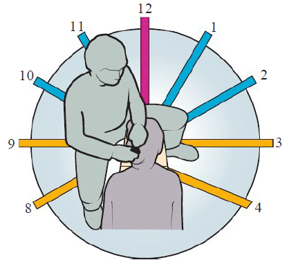 <p>Help identify clinician’s position in relation to the patient</p><p></p><p><strong>Patient’s head </strong></p><ul><li><p>12 o’clock</p></li></ul><p><strong>Feet </strong></p><ul><li><p>6 o’clock </p></li></ul><p></p><p><strong>Left handed — </strong>11 to 4 o’clock </p><p><strong>Right handed — </strong>8 to 1 o’clock </p><p></p><p>6 increments</p><p></p>