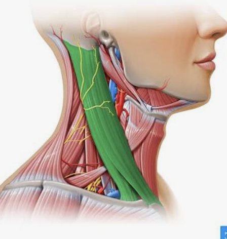 <p>Which muscle is this?</p>