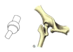<p>Allows a wide range of movements in all directions, eg. shoudler, hip</p>