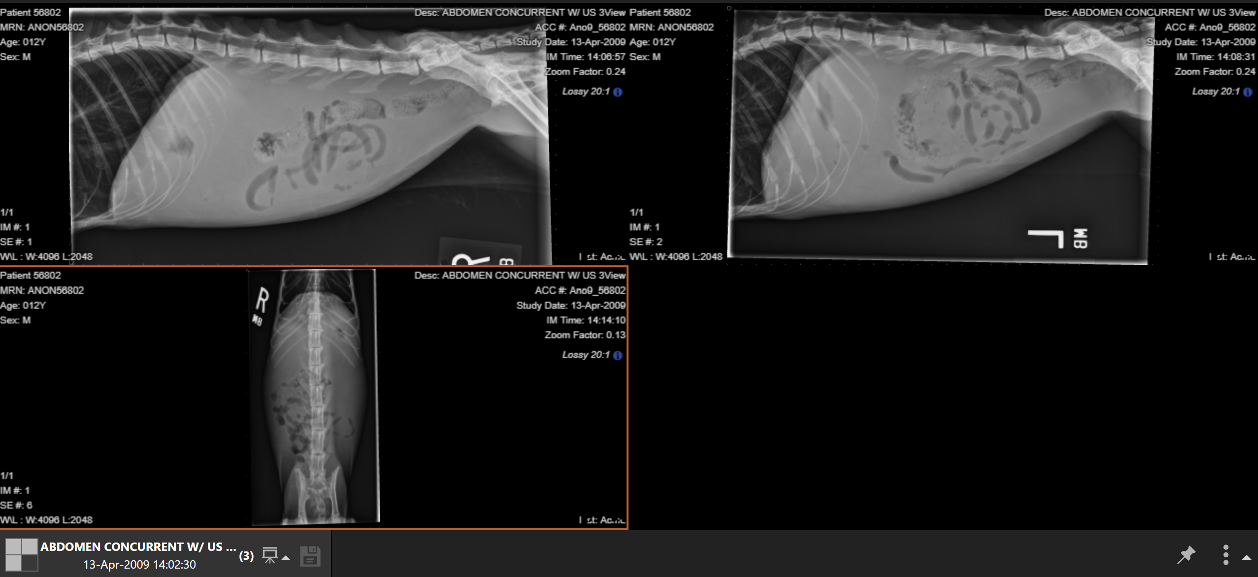 <p>12 YO MN DSH with 1 month history of weight loss: what is present in the vertebral column</p>