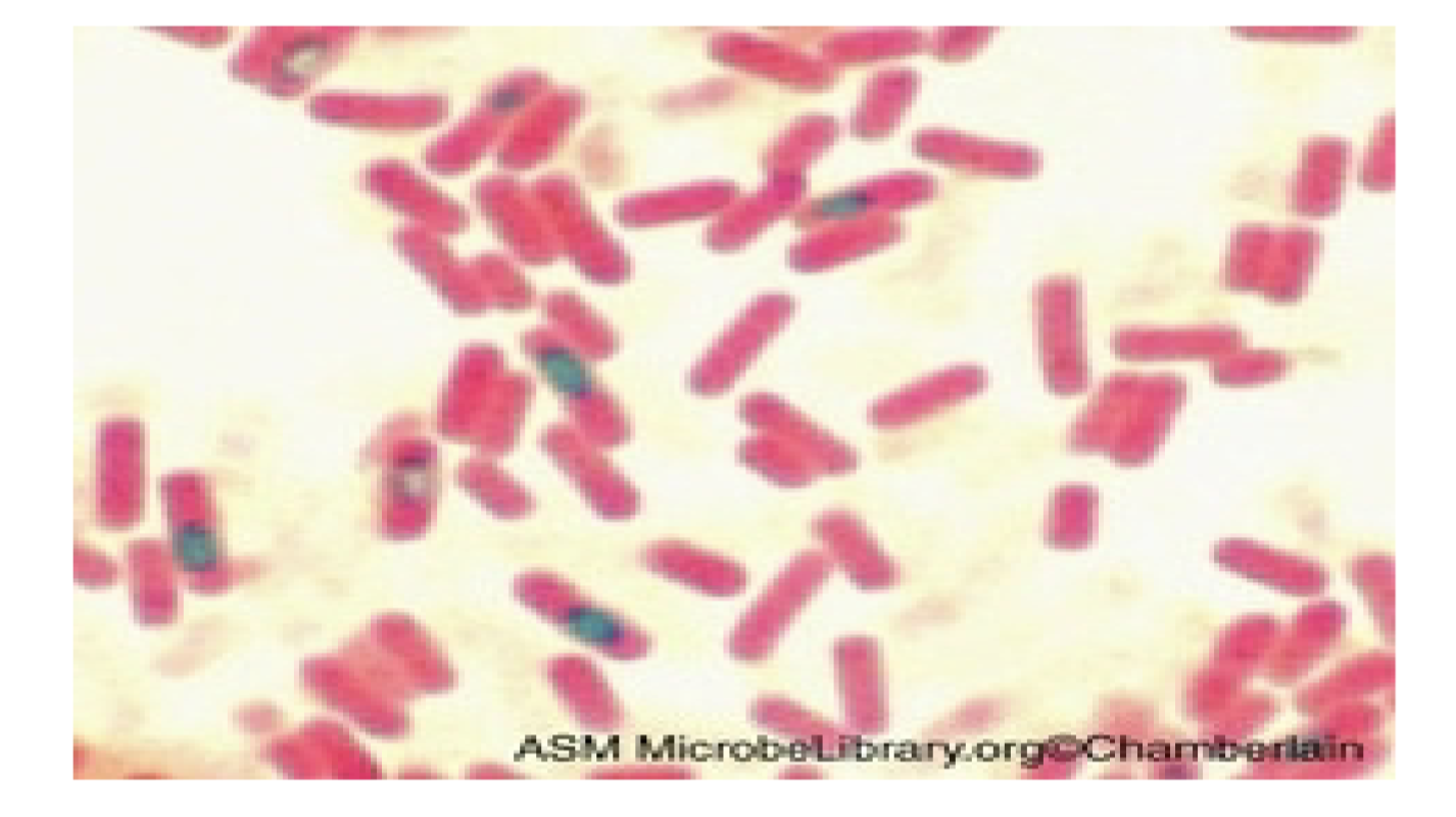 <p>what are the pink and green</p>