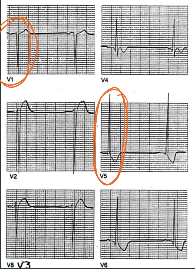 <p>What type of hypertrophy is this?</p>