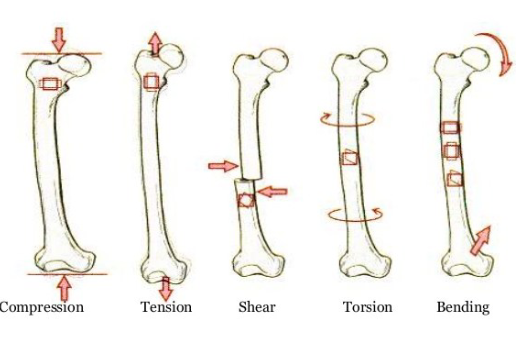 <p>concave side subjected to compression, convex side subjected to tension</p>