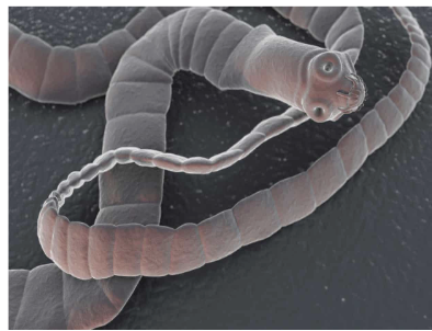 <p>which tapeworm is the <strong>largest</strong> to infect humans?</p>