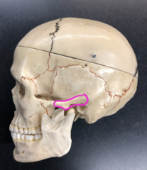 <p>Very back part of the arch only</p>