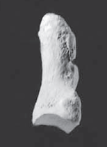 <p>distal foot phalanges (lateral)</p>