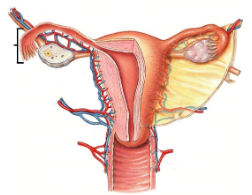 <p><span style="line-height: 17.375px;">Identify </span></p>